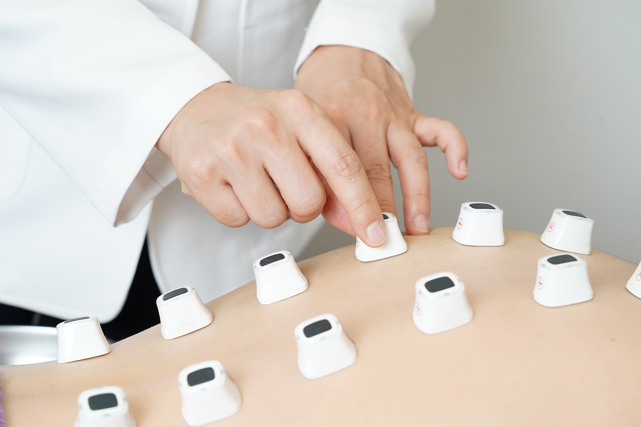 AGA治療クリニックの比較ポイントは何か？